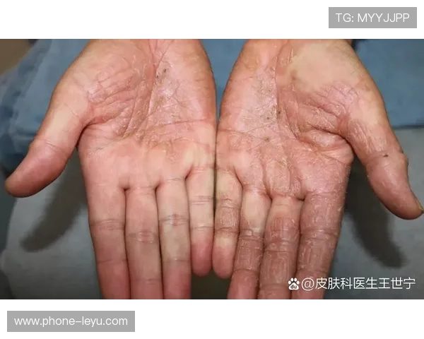 手部接触判定标准详解：怎样才算犯规与普通接触区别